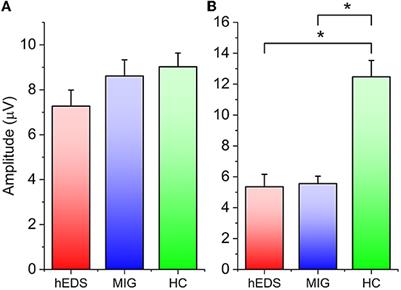 Habituation deficit of visual evoked potentials in migraine patients with hypermobile Ehlers-Danlos syndrome